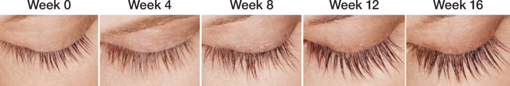 Latisse Before and After