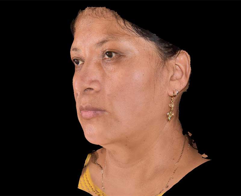 Evoke Before & After Image