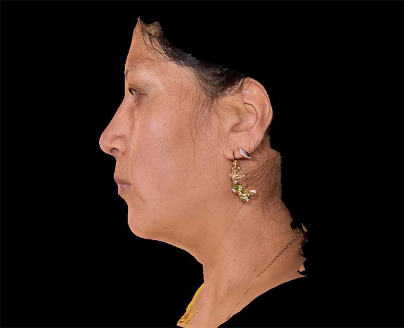 Evoke Before & After Image