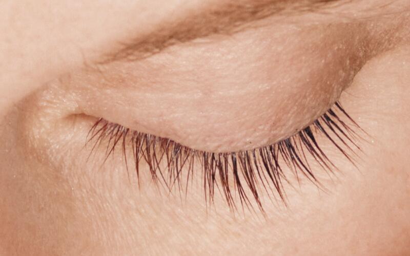 LATISSE Before & After Image