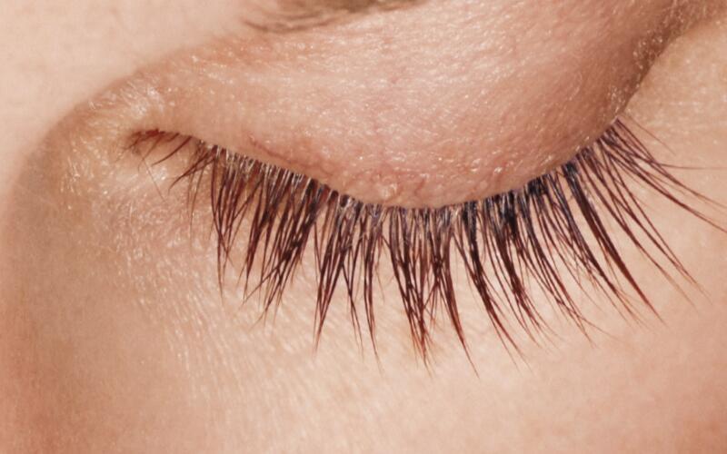 LATISSE Before & After Image